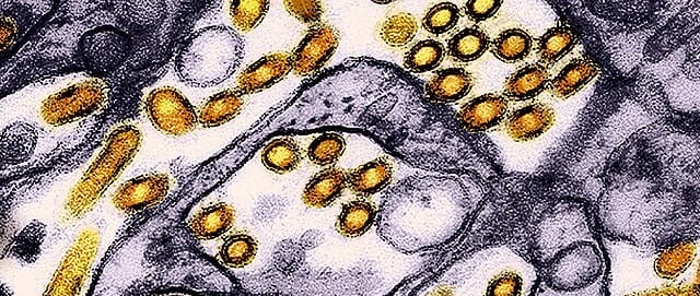 Plague News: First One - 1.31.25