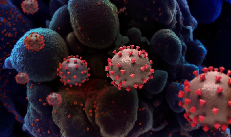 Plague News: Bird Flu, COVID, Measles - 4.15.25