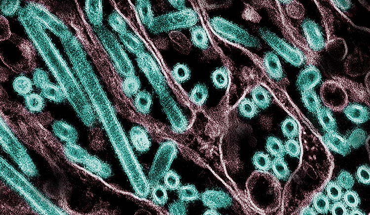 Plague News: Measles Deaths, Bird Flu Updates, COVID Still Here - 3.9.25