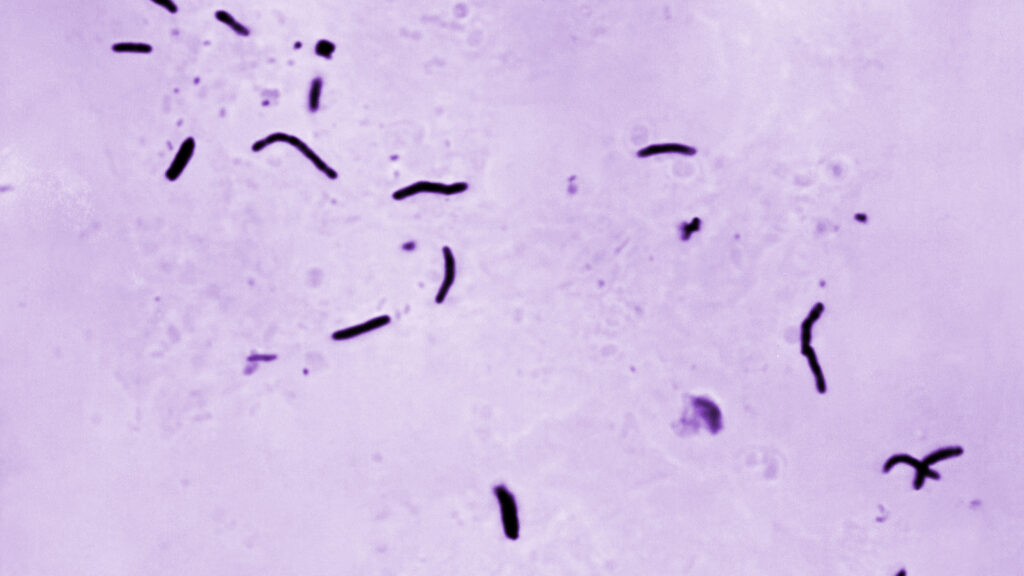 Plague News: Bird Flu and Massachusetts Right to Mask Bills - 2.23.25