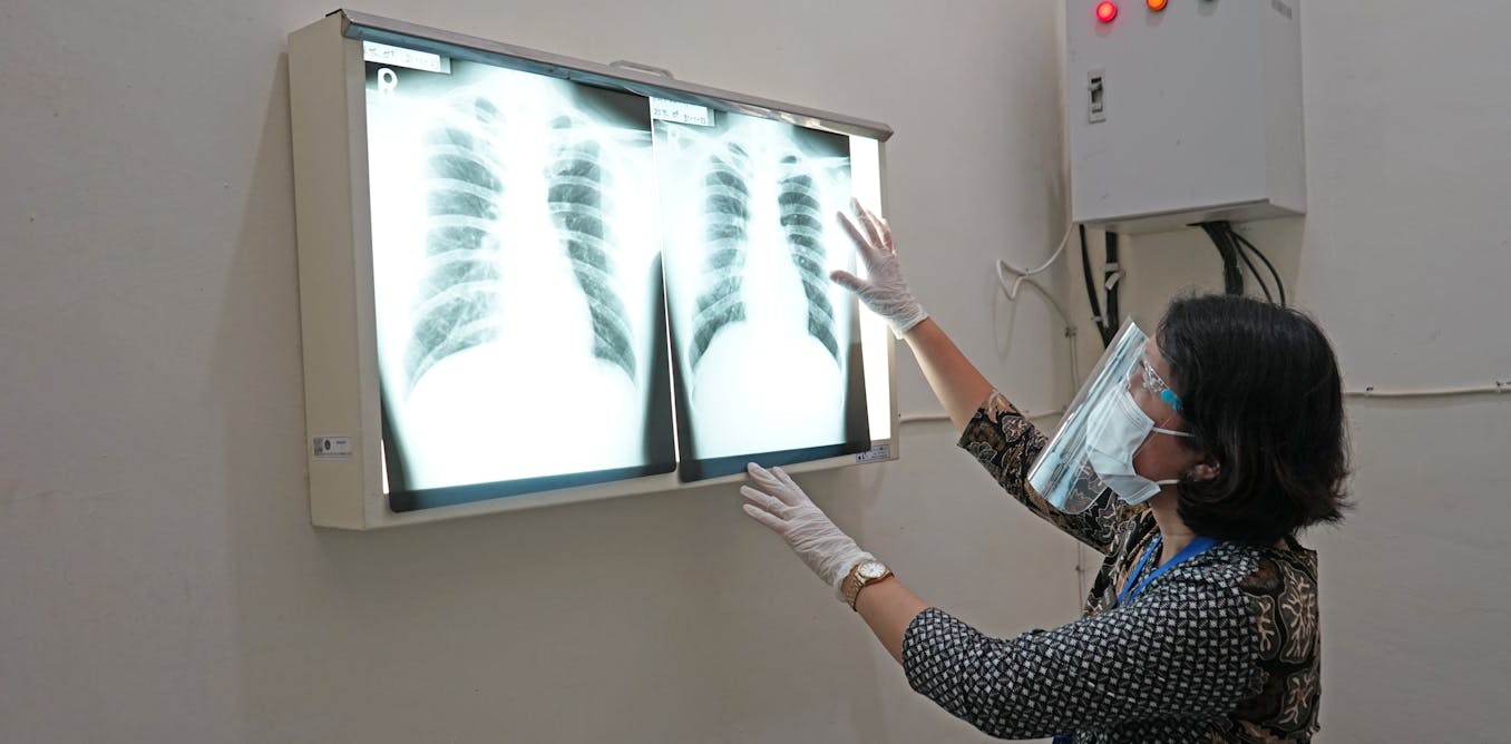 Plague News: Measles Deaths, Bird Flu Updates, COVID Still Here - 3.9.25